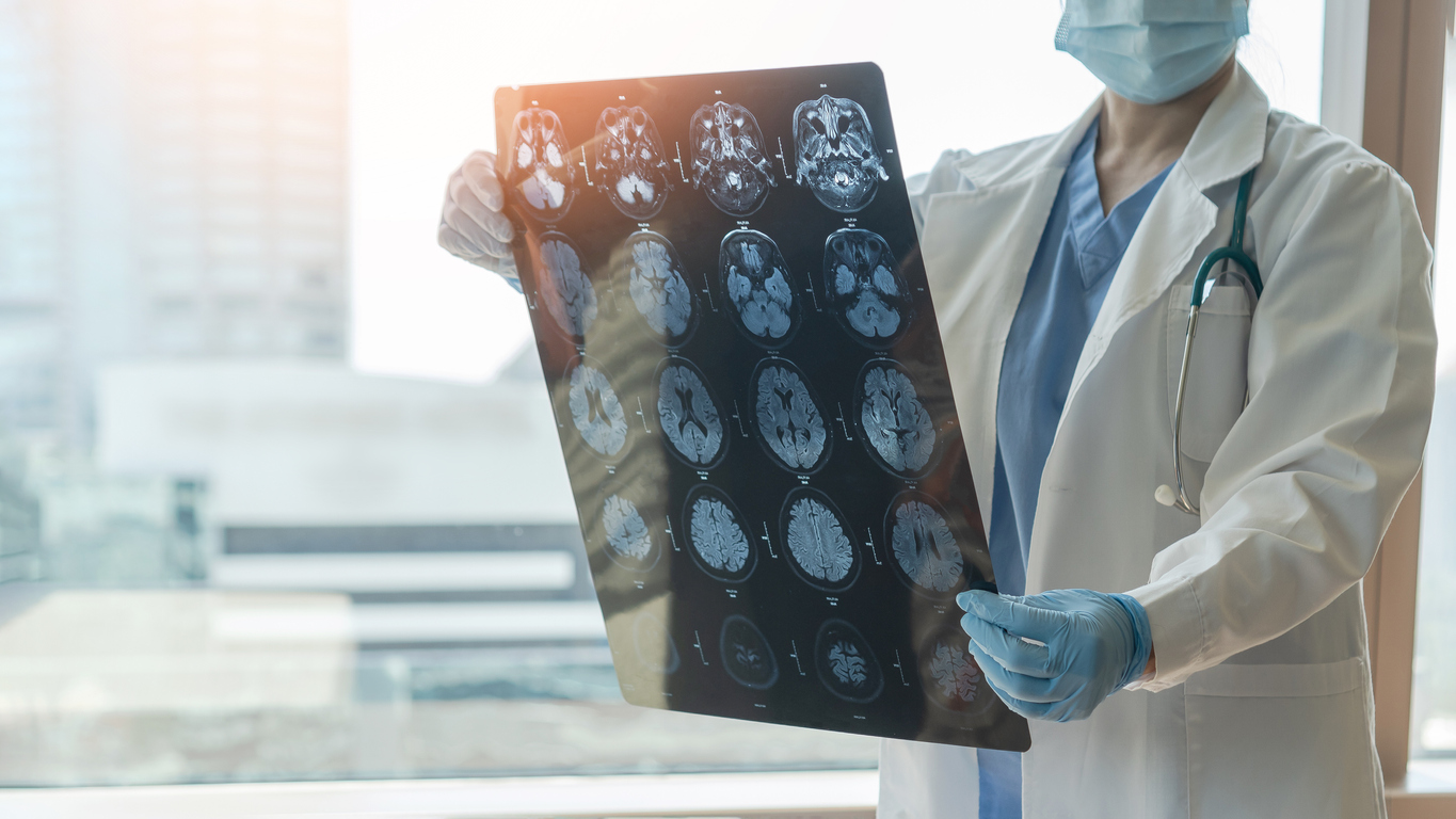 4 Types of Brain Injuries and 3 Levels of Severity