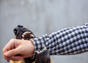 How Can Our Personal Injury Attorneys Help After a Dog Attack in Bedford, TX?