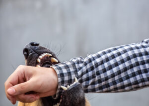 How Parker Law Firm Can Help You With a Dog Bite Injury Claim in Fort Worth