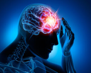 Overview of Brain Injuries